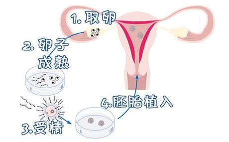 供卵试管代怀过程(供卵试管代怀:新生命的奇迹之旅)